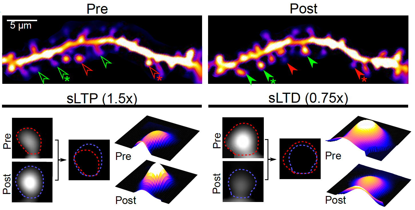 Spine Plasticity