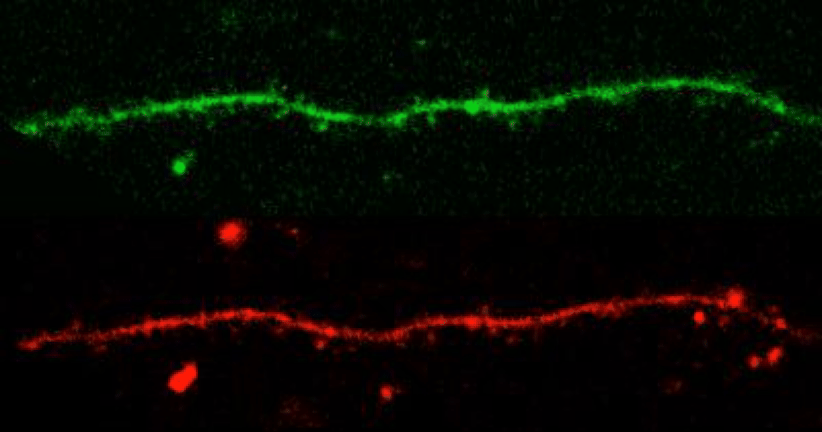 Spine Activity